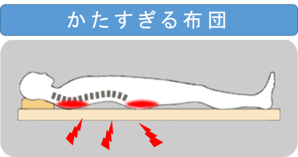 硬すぎる布団は、腰や背中に負担がかかり痛みを感じる