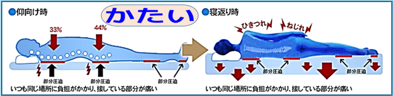 硬すぎるマットレス 腰や肩に負担が集中 不要な寝返りが多い